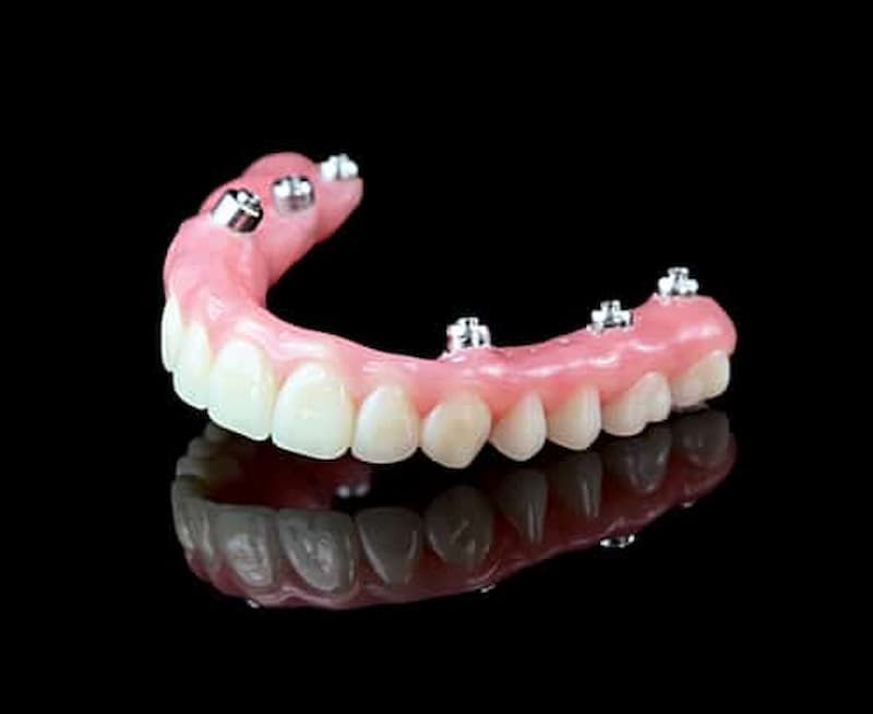 تصویر 1 از قیمت خرید دندان متحرک + فروش ویژه